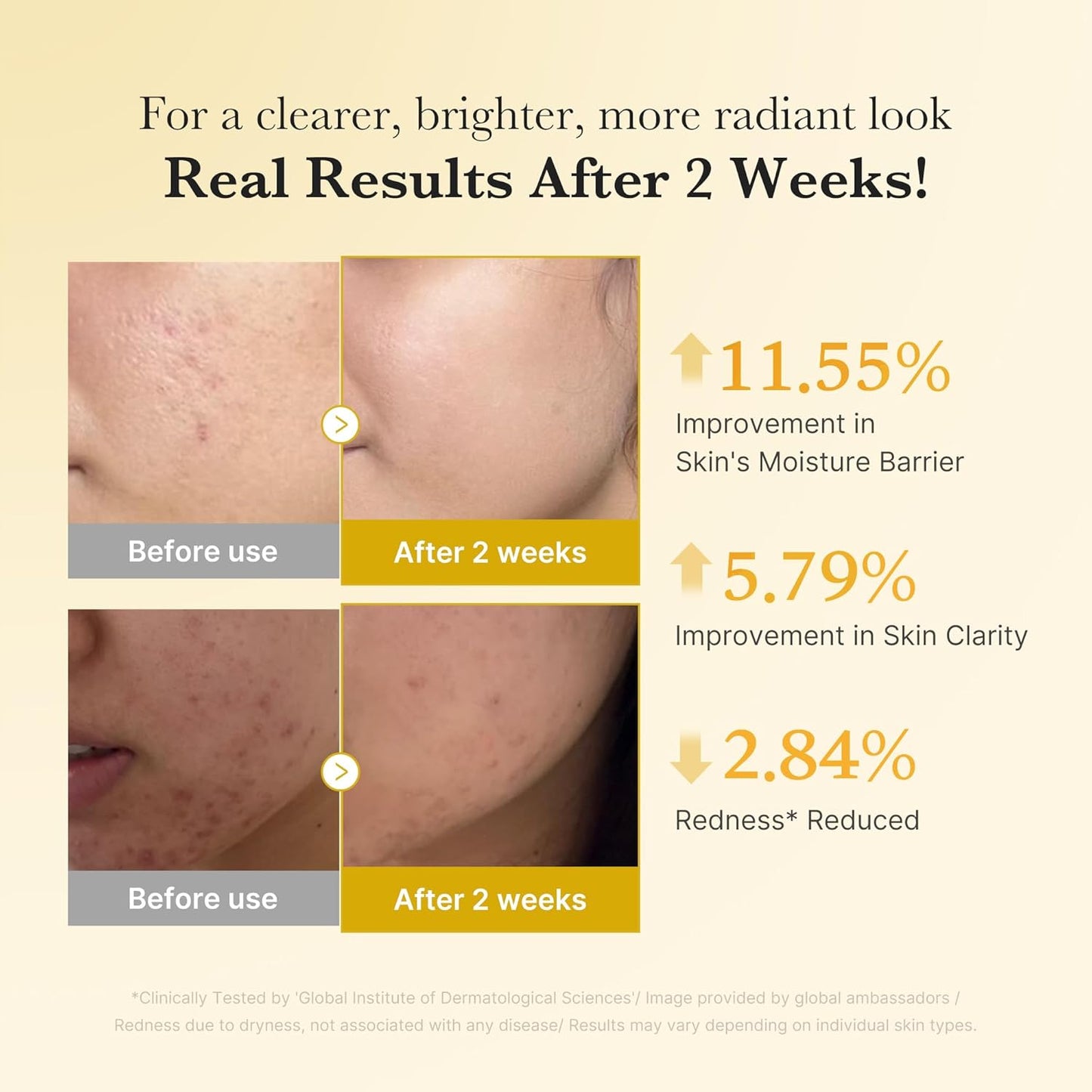 Dark spots DON'T come from what you THINK…