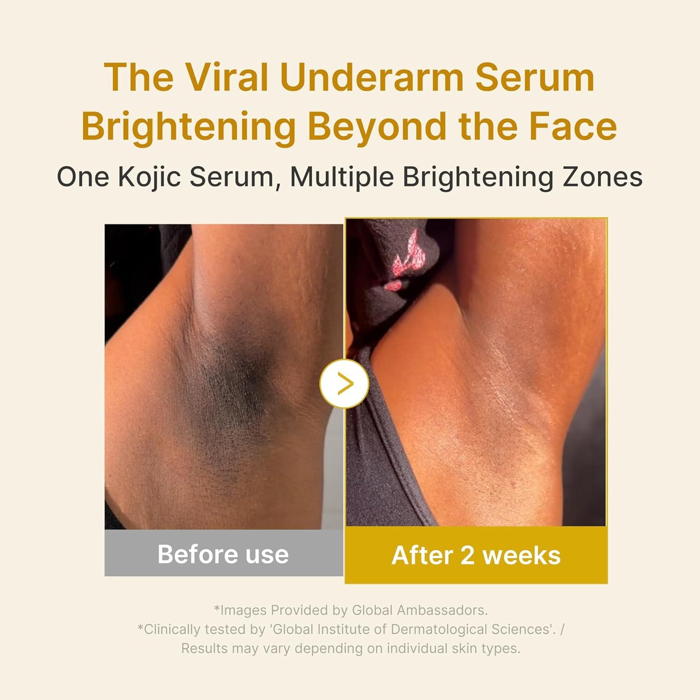Dark spots DON'T come from what you THINK…