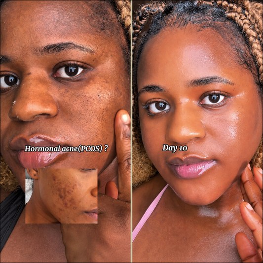 Dark spots DON'T come from what you THINK…